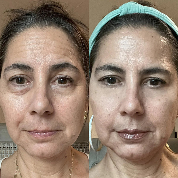 Before and after — Amanda T.