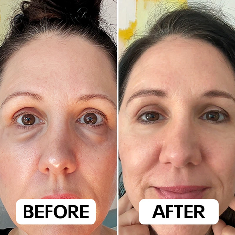 It Delivers Brighter, Firmer, Younger-Looking Eyes