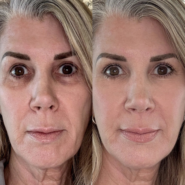Before and after — Amanda T.