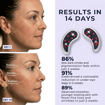 AluneLift™ EyePods